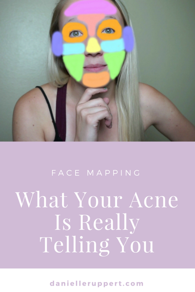 What Your Acne Is Really Telling You